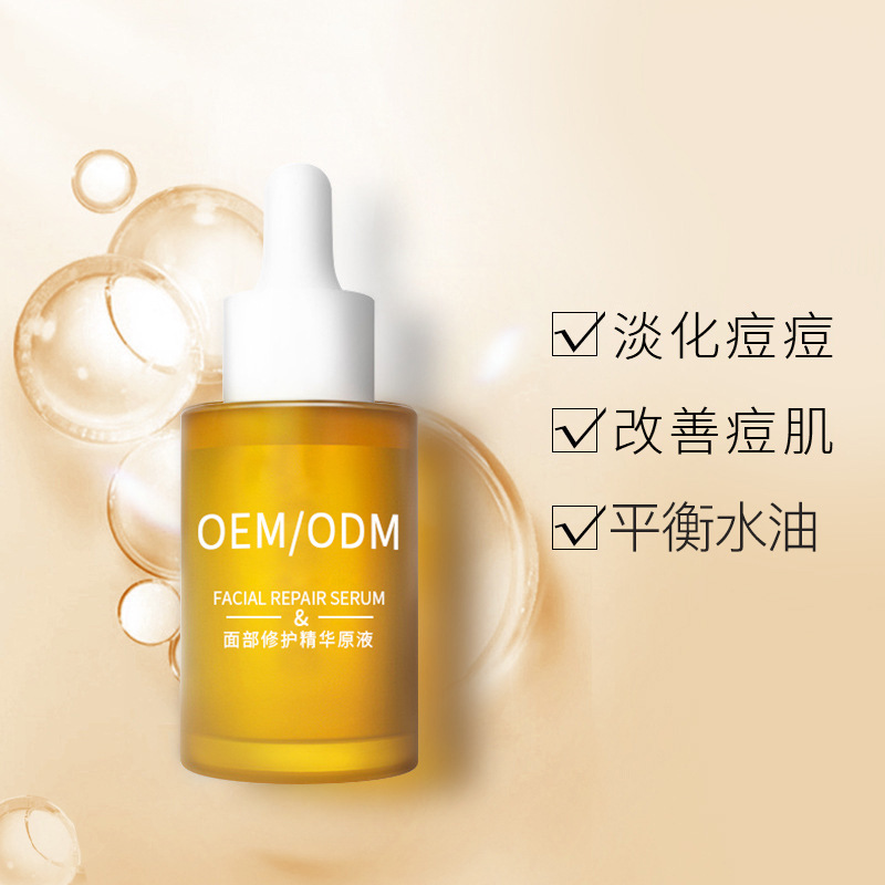 西藏_祛痘精华原液OEM